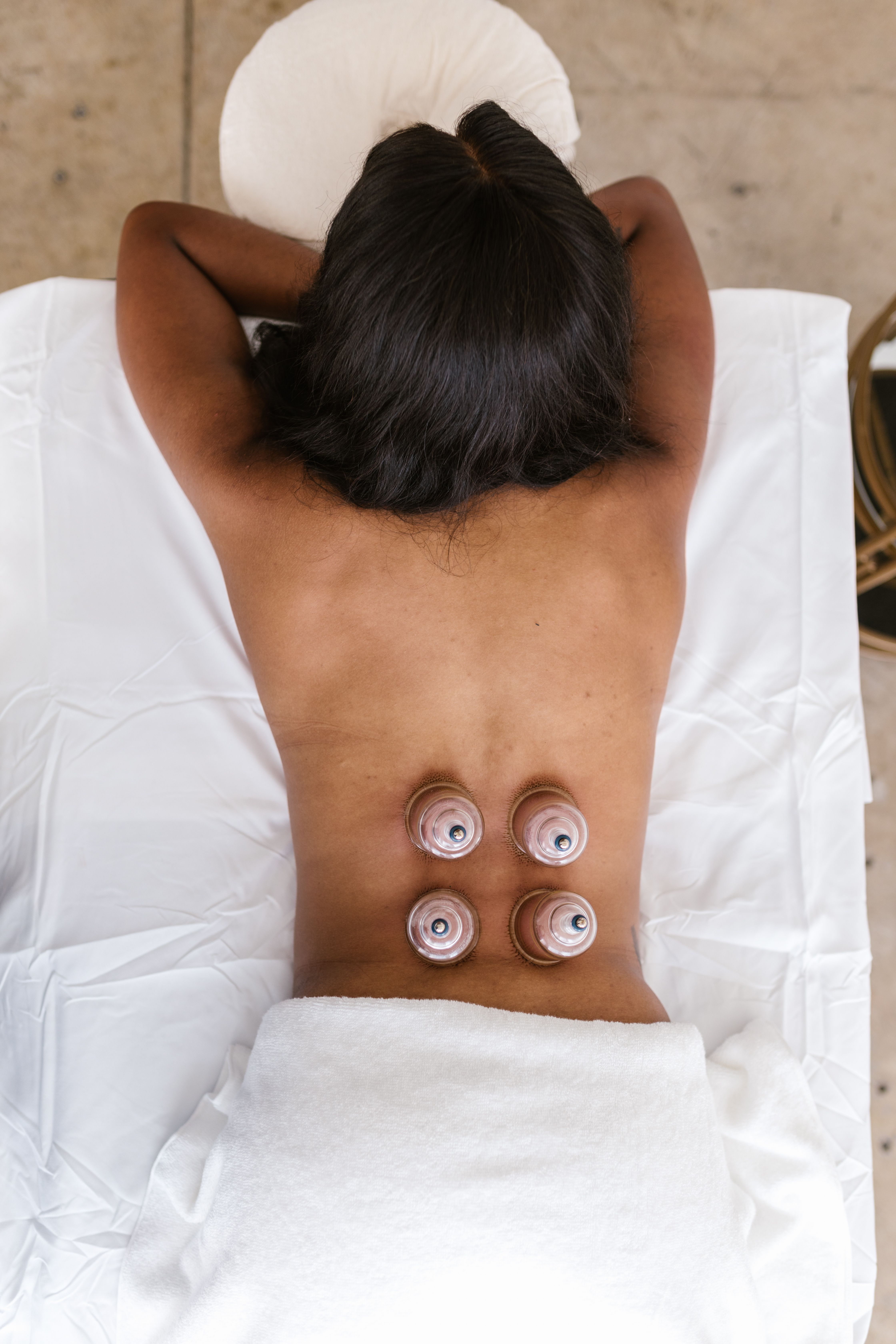 Ventosas Cupping